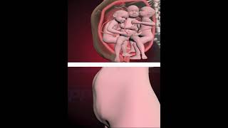 PRECIOUS MOMENTS OF TRIPLETS INSIDE THE WOMB 3D ANIMATION [upl. by Zirkle]