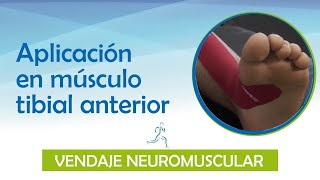 VENDAJE NEUROMUSCULAR  ¿Sabes como se aplica el vendaje en el tibial anterior acá te enseñamos [upl. by Marcelo]