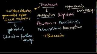 Clostridium perfringens treatment [upl. by Anoblav]