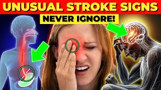 7 Uncommon Signs of Strokes You Should Know About [upl. by Okramed462]