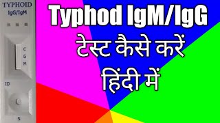 TyphiDot test IgMamp IgG Antibody  Typhoid blood test in hindi  TyphiDot Antibody test [upl. by Nirej]