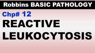 Ch12  Reactive Leukocytosis  EBV Infection  Infectious Mononucleosis  Blood Pathology [upl. by Matilde]