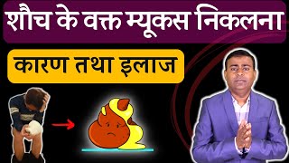 शौच के वक्त म्यूकस निकलना  कारण तथा इलाज MUCUS IN STOOL stool me mucus aana mucus [upl. by Norbel]