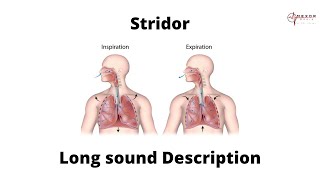 Stridor  Lung sound description  Upper airway obstruction [upl. by Sofie]