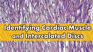 Fibrocartilage vs Cardiac Muscle Histology FAQ [upl. by Lyrem]