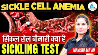 Sickle cell Anemia in hindi  Sickle cell test  Hematology Lecture  MLT Education Point [upl. by Llenaej690]