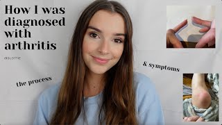 HOW I GOT DIAGNOSED WITH ARTHRITIS  First Symptoms and Diagnosis Process [upl. by Llevad]