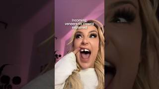 Tana Mongeau Tooth Falls Out Of Mouth 😬 Orthodontist Reacts [upl. by Jessey128]