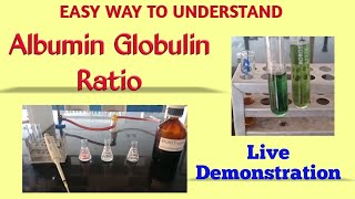 Albumin globulin ratio  Total protein estimation  Biuret method  Albumin estimation  BCG method [upl. by Rossing]