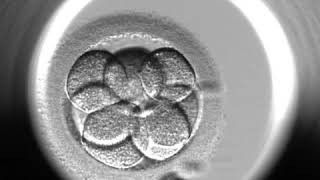 Embryoscope Video [upl. by Rubin]