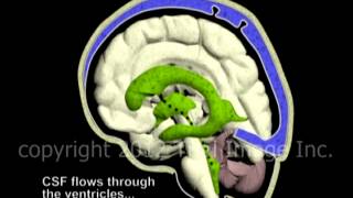 Hydrocephalus and Cerebrospinal Fluid CSF circulation by Dr Cal Shipley MD [upl. by Mellette]