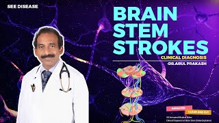 BRAIN STEM STROKES  Diagnosis and Localization  NEUROLOGY [upl. by Hardigg606]