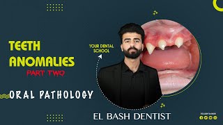 developmental anomalies  teeth anomalies 2  oral pathology عزت شومان [upl. by Feodora]