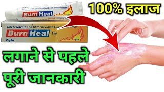 Burn Heal Cream Use in HindiAag se jale ka Dava How to use Burn heal creamBurn Heal kaise Lagayen [upl. by Elish276]