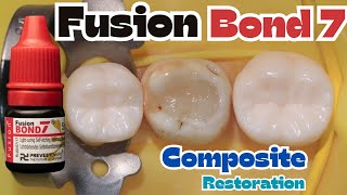 Fusion Bond 7 🔴 Class I Composite Restoration on Mandibular Second Molar ⚪️ Prevest Denpro [upl. by Weiser291]