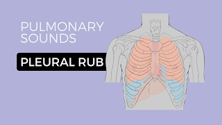 05  Lung Sounds  Pleural friction rub 🎧 [upl. by Iknarf]