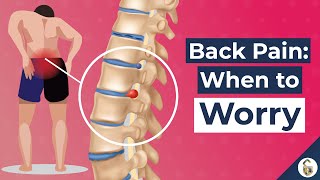 Low Back Pain Causes and 7 Worrying Signs [upl. by Neeruan566]