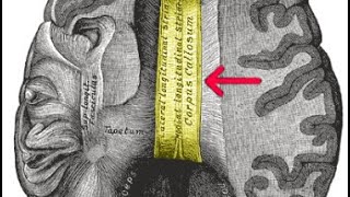 SPLIT BRAIN SYNDROME HIDDEN KNOWLEDGE LECTURE [upl. by Bowyer]