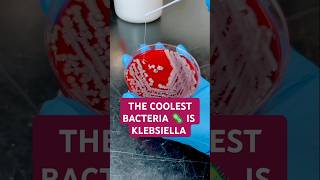 Klebsiella is a common species of bacteria found in our bodies but can also be harmful at times [upl. by Carr]