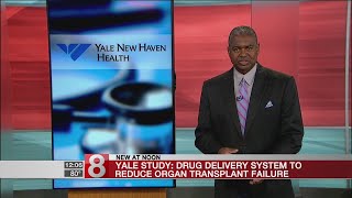 Yale develops drug delivery system to reduce organ transplant complications [upl. by Zebaj]