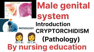 PathologyMale genital system Introductioncryptorchidism Bsc nursing [upl. by Lemrej]