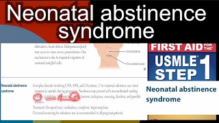 Neonatal abstinence syndrome in HindiUrdu by first aid for USMLE step 1 [upl. by Horten980]