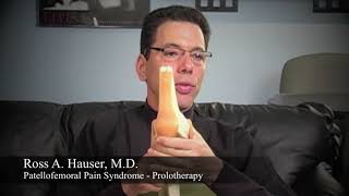 Patellofemoral Pain Syndrome treatment with Prolotherapy [upl. by Aigroeg172]