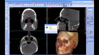 Quick launch 3D volume with 3D photo from Planmeca Romexis® to Dolphin Imaging [upl. by Enyt]