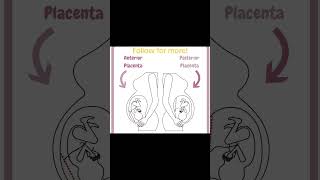 Why Your Placenta Location Matters [upl. by Picardi478]