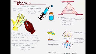 Tetanus Clostridium tetani  Microbio Symptoms Diagnosis Treatment Prevention etc [upl. by Alameda324]