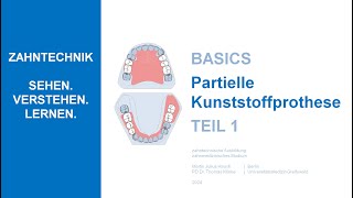 Partielle Kunststoffprothese  Teil 1 [upl. by Nalced707]