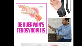 De Quervains tenosynovitis  thumb pain [upl. by Tewell]