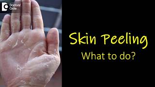 When is a Spot More than a Spot Skin Lesions and Cancers [upl. by Ecirtnuahs]