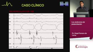 Electro caso rápido Dr Angel Ferrero de Loma [upl. by Kentigerma464]