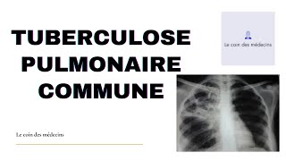 TUBERCULOSE PULMONAIRE COMMUNE [upl. by Sioled738]