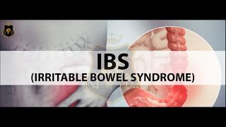 What is IBS [upl. by Euqinimod]