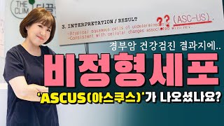 자궁경부암 검진결과 비정형세포ascus 아스쿠스가 나오셨어요 추가검사받으시고 치료받으시면 되세요 너무 걱정하시마세요 [upl. by Conover]