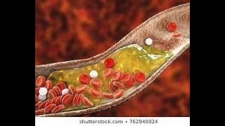 HSC BOTANY  CHAPTER 3  LIPID 02   MD SADMAN  DHAKA MEDICAL COLLEGE [upl. by Portwine]