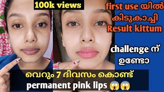 വെറും 7 ദിവസം കൊണ്ട് 😱pink lips naturally at home How to get pink lips at home Malayalam [upl. by Tahmosh635]