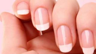 How To Whiten Your Nails Using Denture Cleaner Be Patient [upl. by Umont709]