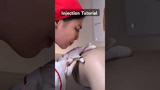 Injection Tutorial tutorial injection shorts littos [upl. by Anaek]