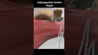 Subscapularis Tendon Repair 3danimationsurgery shorts [upl. by Guzel]