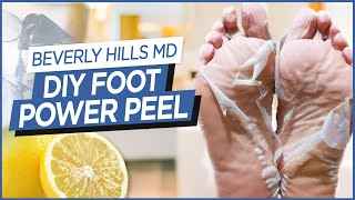 How To Make DIY Foot quotPower Peelquot Easy to make  Beverly Hills MD Beauty Tips [upl. by Inaoj96]