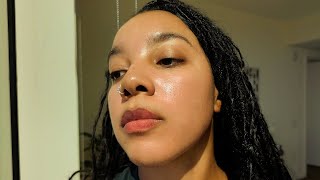 How I Cleared My Acne Dark Spots amp Hyperpigmentation  Glass Skin Routine [upl. by Eegnat]