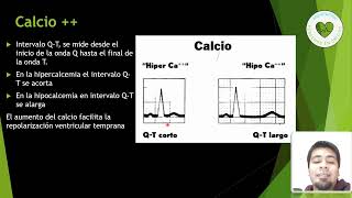 hipercalcemia e hipocalcemia en electrocardiograma [upl. by Vanzant]