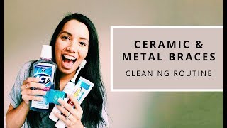 CERAMIC amp METAL BRACES every day cleaning routine [upl. by Aiuqet]