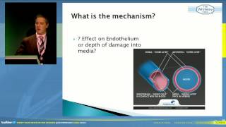 Clarivein MOCA  video of Prof Mark Whiteley lecturing April 2013 [upl. by Tala]