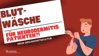 Blutwäsche Eine Behandlungsoption für Neurodermitis Patienten [upl. by Annahsit]