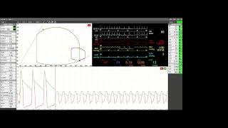 A Cardioprotective Mindset Myocardial Energetics and Ventricular Unloading in Cardiogenic Shock [upl. by Nyre657]