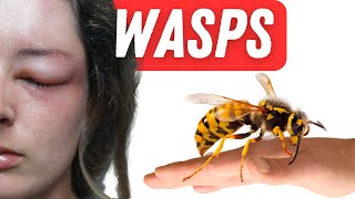 WASPS  What To Do When Stung  10 Facts About You Need To Know [upl. by Leunamesoj]